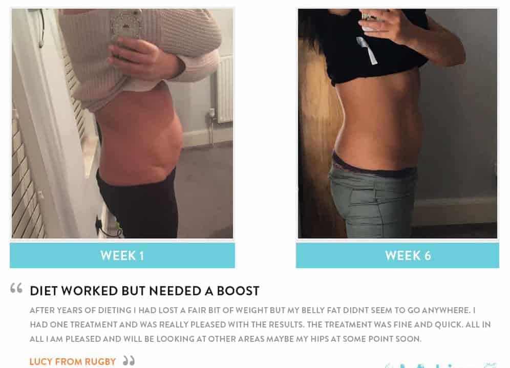 Before and After Dieting West Ruislip