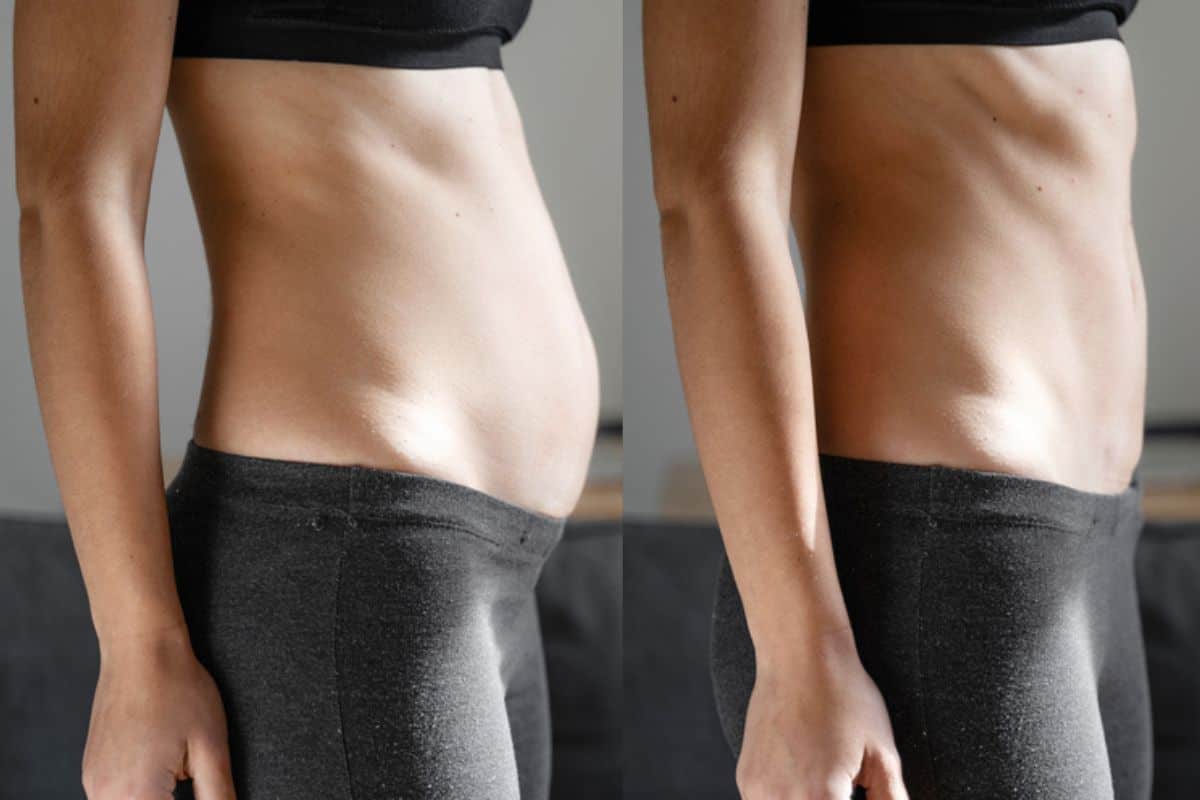 Post-Pregnancy: What Happens to Your Abdominal Muscles After Birth West Ruislip