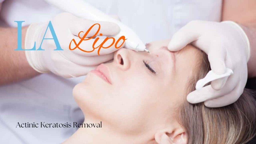 actinic keratosis removal West Ruislip