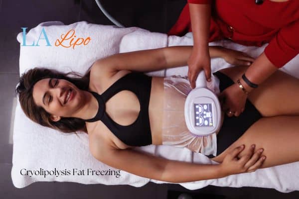 woman getting cryolipolysis West Ruislip