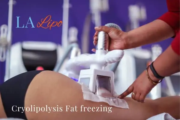 women getting fat freezing West Ruislip