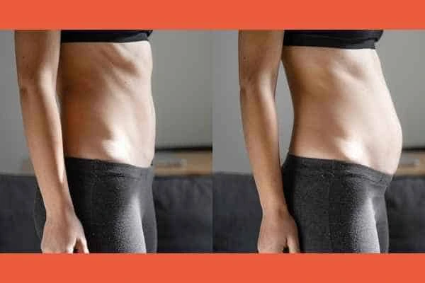 LA-EMS Body Sculpting results West Ruislip
