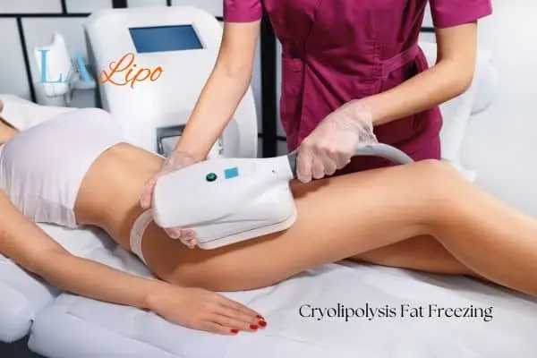 Woman receiving coolsculpting West Ruislip treatment on her thighs