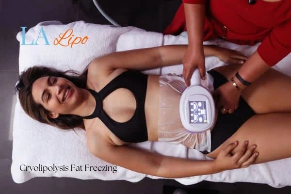 woman getting cryolipolysis West Ruislip