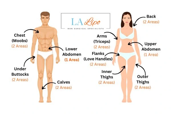 LA LIPO Cryolipolysis Areas West Ruislip