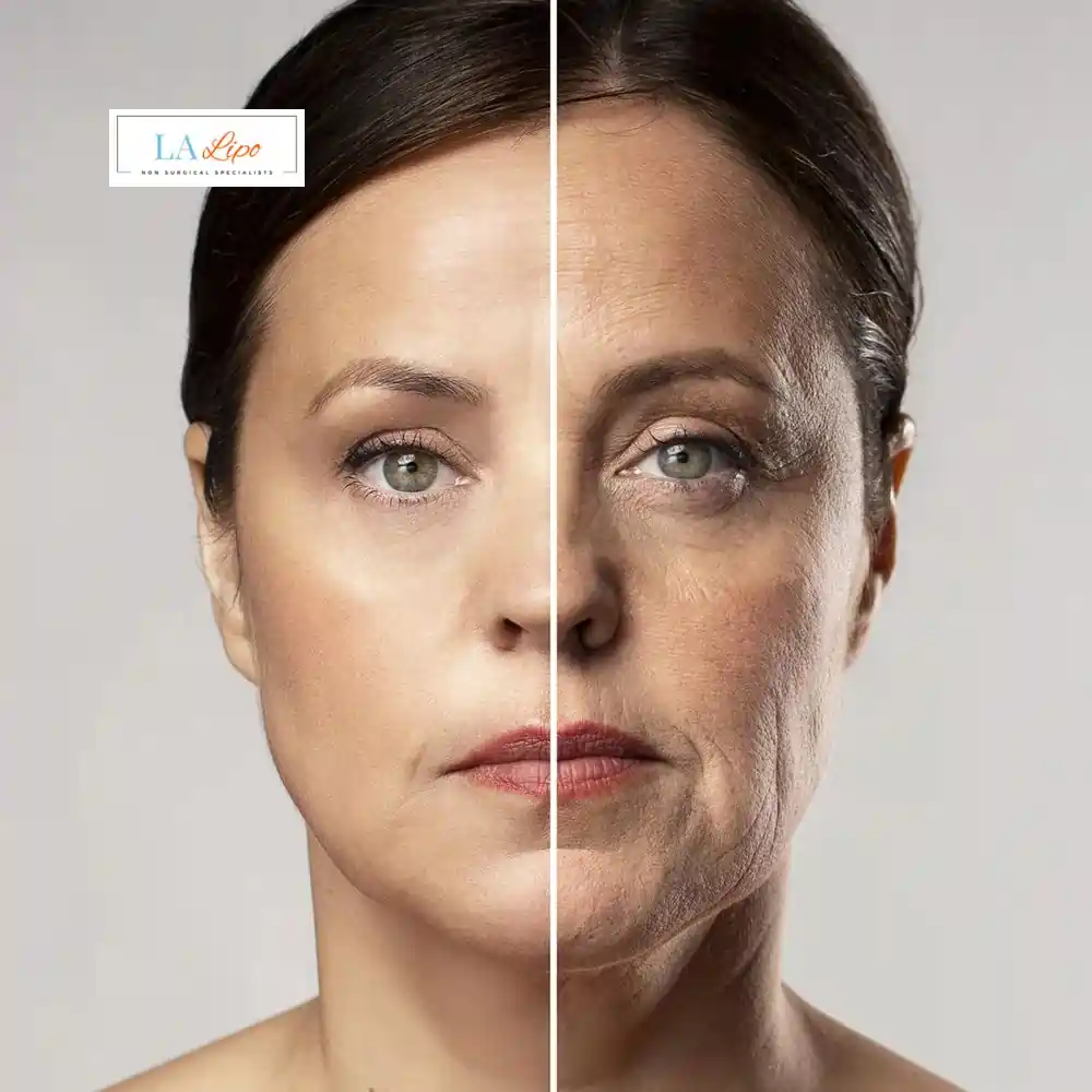 How Can You Tell If Non-Surgical Skin Tightening Is Right for You West Ruislip?