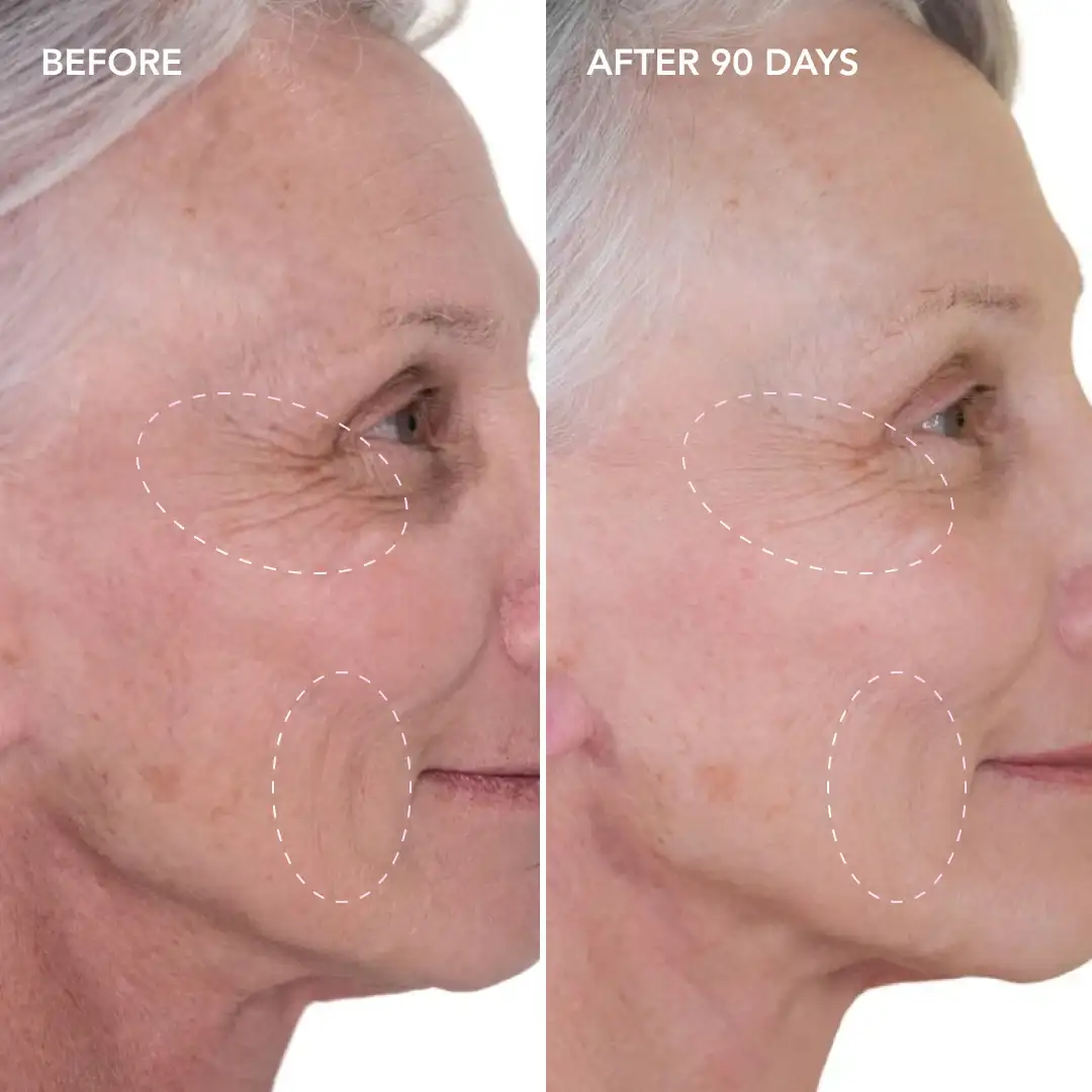 When will you see results West Ruislip